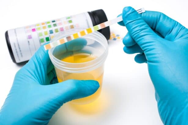 Urinanalyse