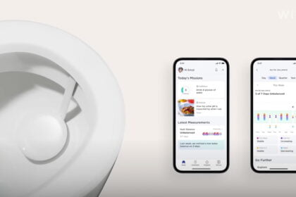Withings U-Scan